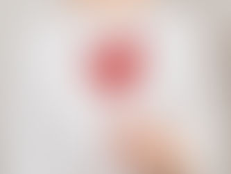 SÃndrome Metabólica: Entenda os Critérios