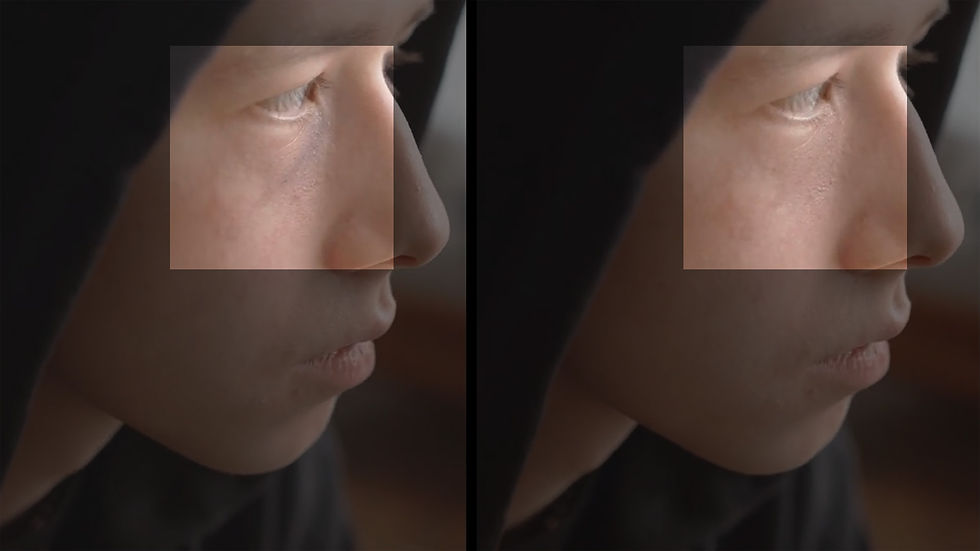 Simple bruise removal with CopyCat.