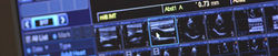 kardiologie-slideshow4.jpg
