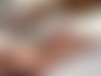 Unlocking Radiant Skin: The Benefits of Microneedling and PN Skin Booster Combination