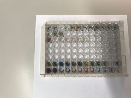 Green color: New indicator displacement assays for pyrophosphate with Nickel