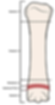 Drawing of a long bone indicating its anatomical parts: epiphysis, metaphysis, diaphysis, epiphyseal plate