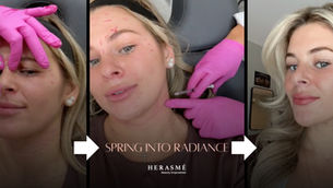 A three-panel before-and-after blog banner for Herasme Beauty showing a client receiving facial aesthetic treatments with pink-gloved hands, followed by a glowing, refreshed result. Text overlay reads "Spring Into Radiance" with the Herasme Beauty Empowered logo.