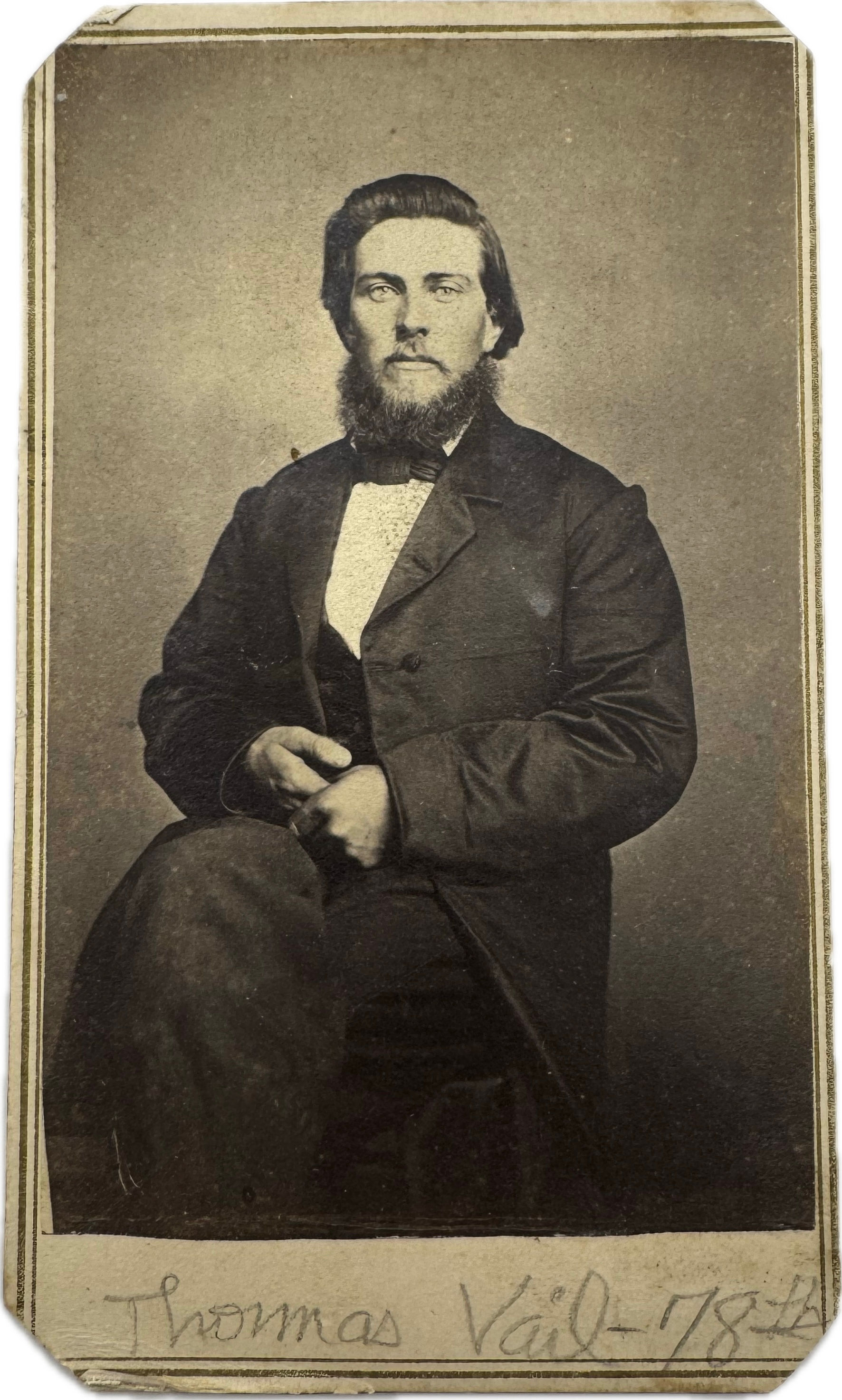 CDV of Union Soldier Thomas J. Vail In Civilian Clothing Died Nashville