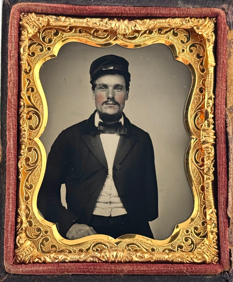 1/9th Plate Ambotype of A Man Missing His Arm