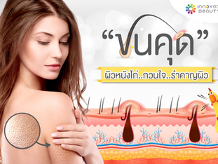 "ขนคุด" ผิวหนังไก่...กวนใจ...รำคาญใจ