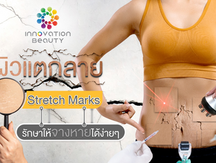 รอยแตกแยก ผิวไม่เรียบเนียน ผิวลายบนเรือนร่าง โดยไม่รู้ตัว