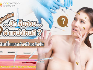 👸...ปักเข็มสวย....ตำเเหน่งไหนดี ❓