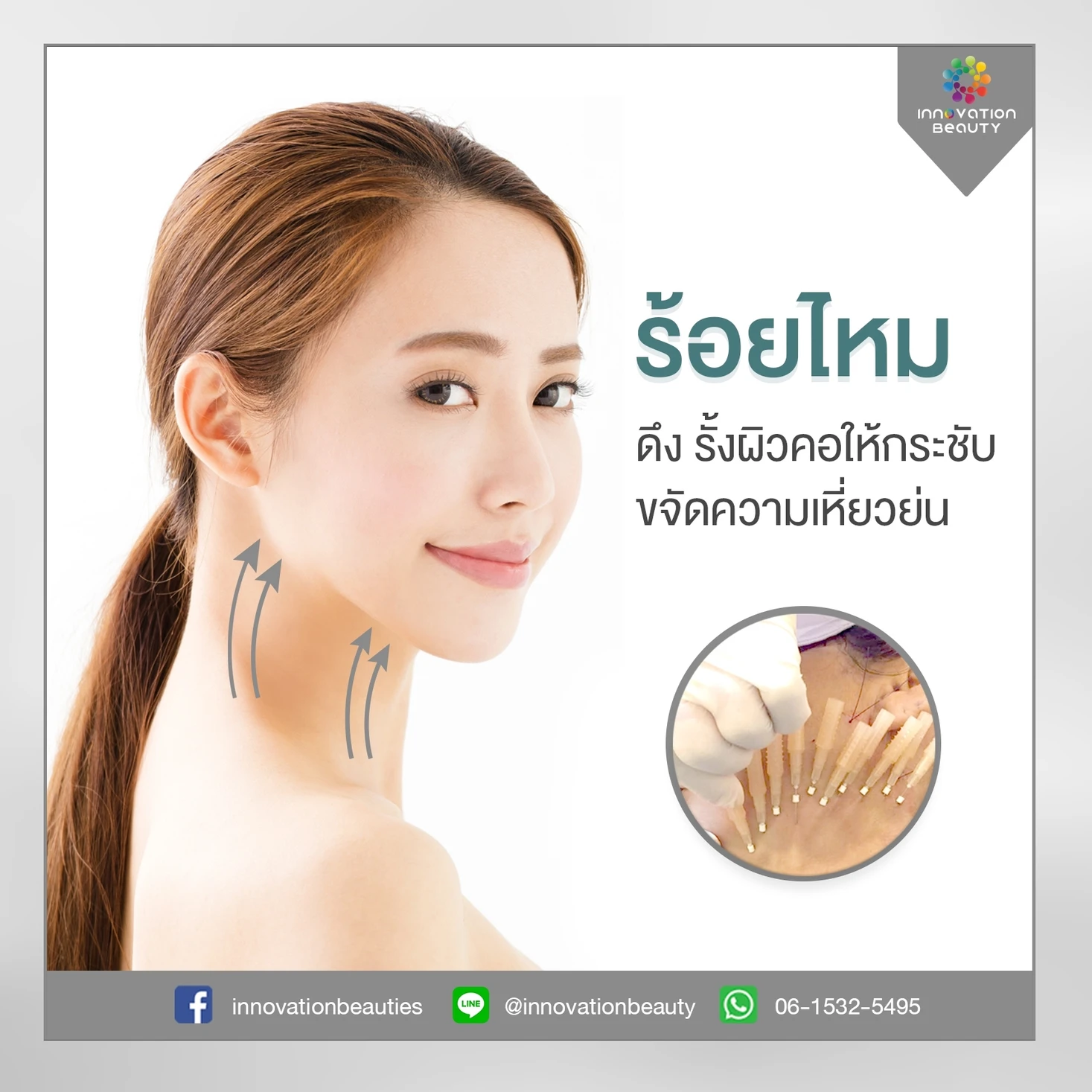 การร้อยไหม