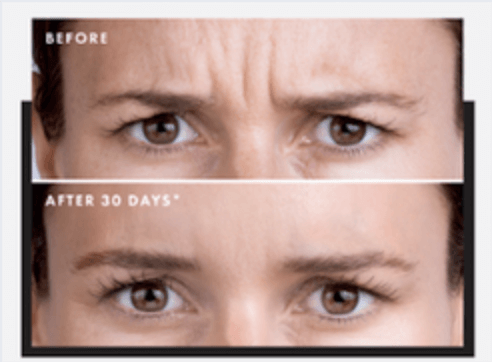Before and After