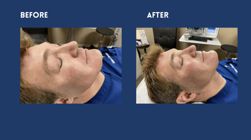 Aquagold before and after