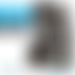 Reduza seus custos no pós-cirúrgico de retina ou buraco de mácula. Alugue sua cadeira oftalmológica na Speed Locações!
