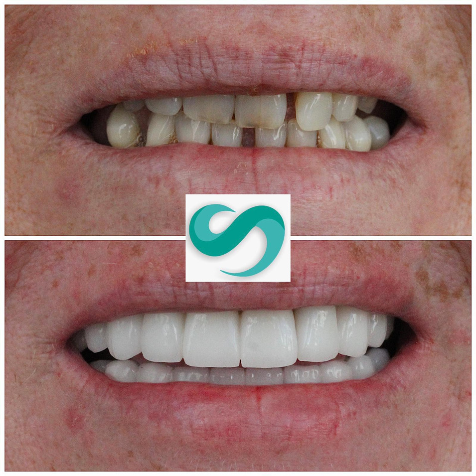 Joy is happy with her new smile.