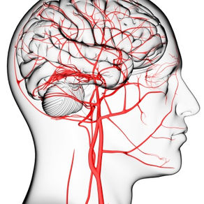 Are you at risk of suffering a stroke?