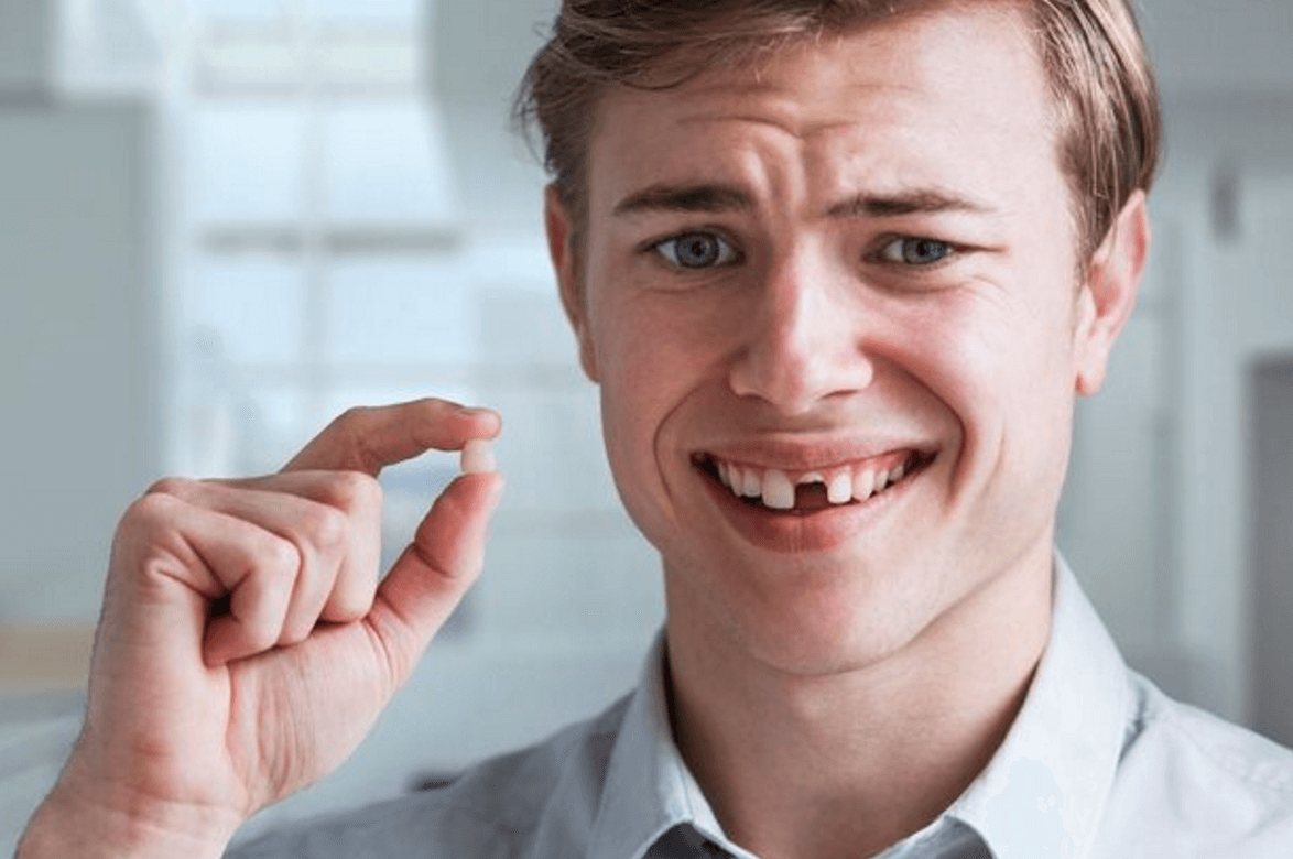 Giấc mơ gãy răng, rụng răng đem đến ý nghĩa gì? Đánh con gì? content media