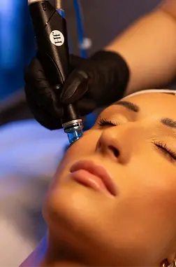 Rectangle 102 (1).webp