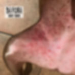 Thumbnail: Skin Therapy Balm