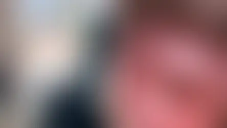 Falsa Profissional de Estética é Investigada por Deformação Facial em Pacientes em MS