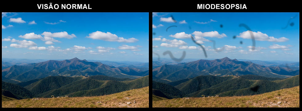 MIODESOPSIA.jpg
