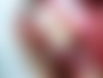 The A-Z of Dentistry - Abrasion