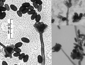 Stachybotrys Chartarum