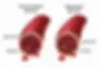 BloodGlucoseImage2Feb231200x800.jpg.webp
