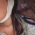 Courtney Sanders Epilepsy