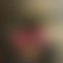 Shunt Happens with Hydrocephalus