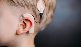coclearimplant.jpg