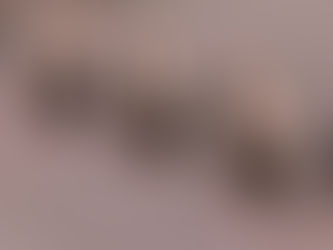 Strategies for Mitigating Transistor Failures in Modern Circuits