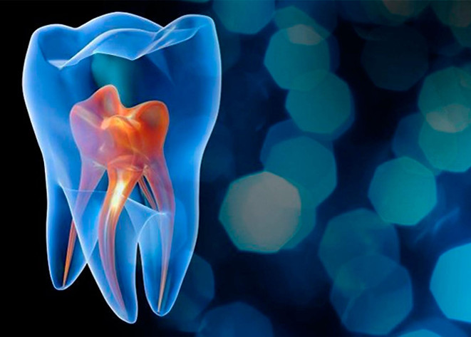 endodoncia.jpg