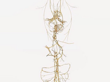 Why Your Vagus Nerve Is Key To Overcoming Chronic Inflammation