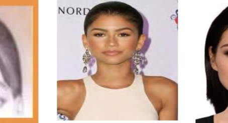 Fizyonomide dar saç çizgisi nasıl yorumlanır?