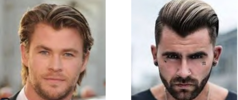 Fizyonomide M Biçimli Saç Tipi