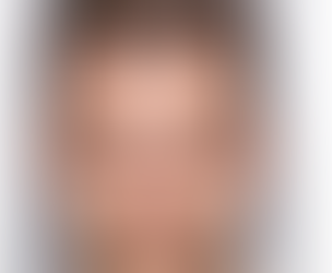 Yüzünüz genel hatlarıyla bir dikdörtgene mi benziyor?