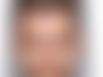 Yüzünüz genel hatlarıyla  bir dikdörtgene mi benziyor?