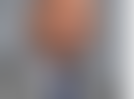 Fizyonomide Yumurta Kafa