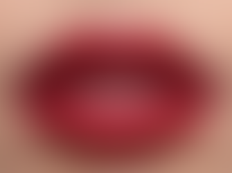 Fizyonomide Dudaklar