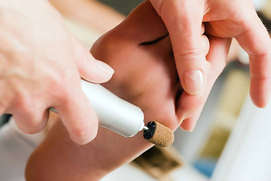 Dry Cracked Skin, Callus