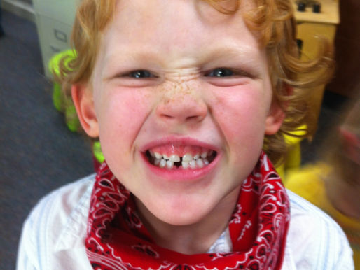 Aaron lost his 1st tooth!!!