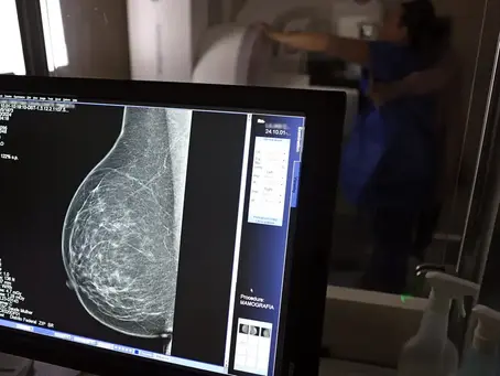 Cerca de 77 mil mulheres aguardam mamografia pelo SUS