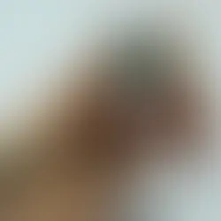 Fiocruz mantém alerta para síndrome respiratória grave