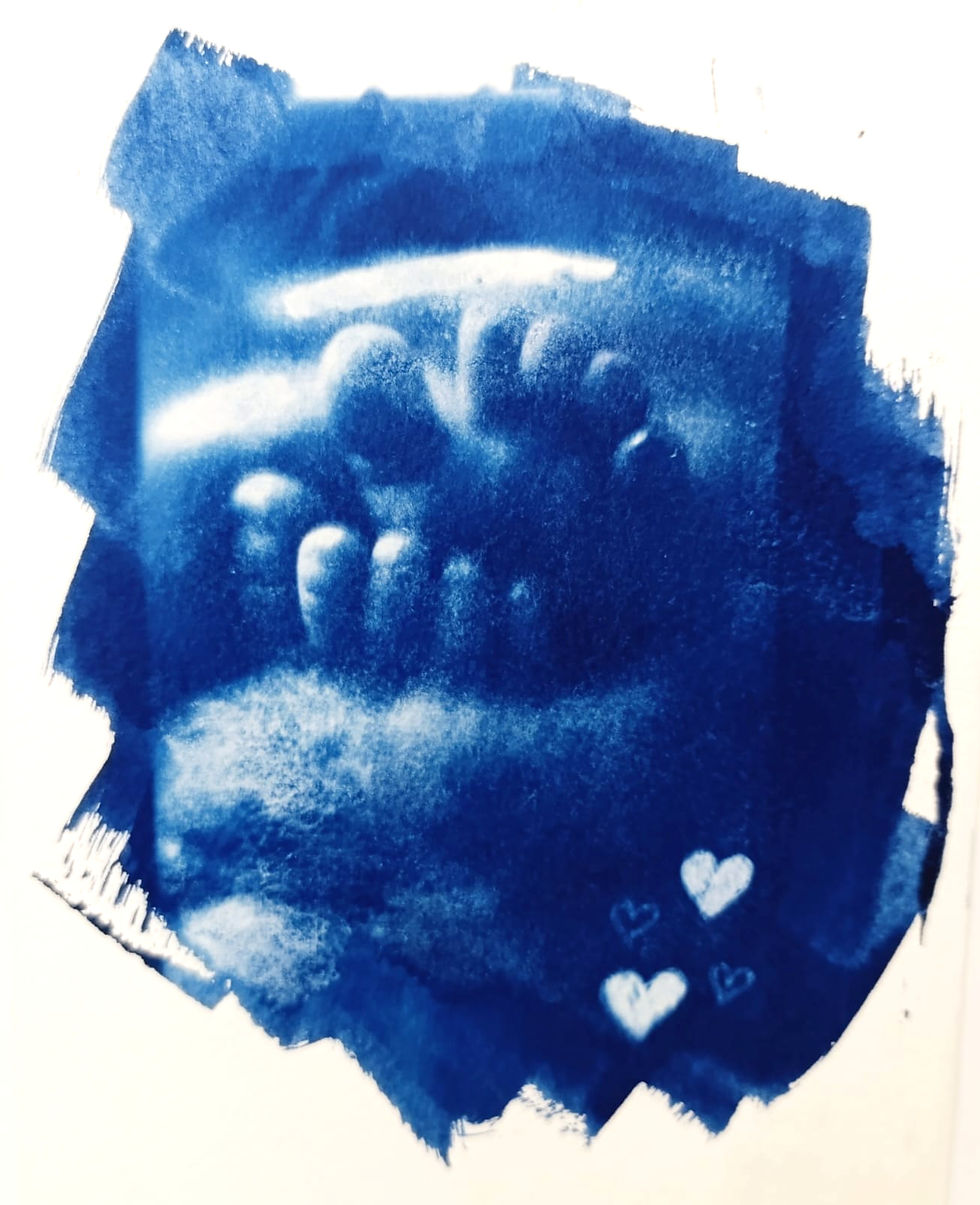 רגלים של תינוק בהדפס צייאנוטיפ