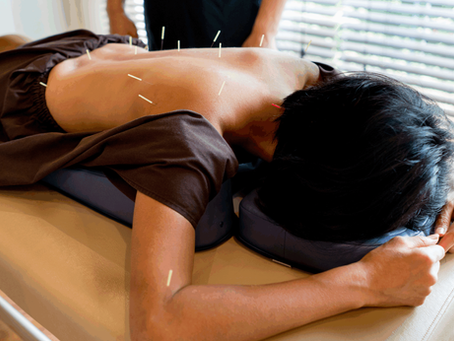 How Often Should You Get Acupuncture? A Beginner’s Guide
