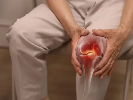Does Acupuncture Help With Arthritis and Joint Pain?