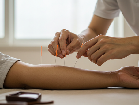 How Often Should You Get Acupuncture? A Beginner’s Guide