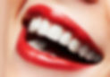 cosmetic-dental-veneers-etobicoke-on.jpg