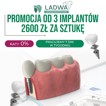 3 імпланти сайт.png