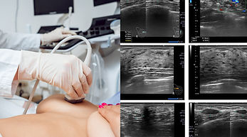 echographie mammaire.jpg