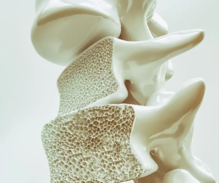 Osteoporosi e movimento: perché allenarsi in modo intelligente può fare la differenza